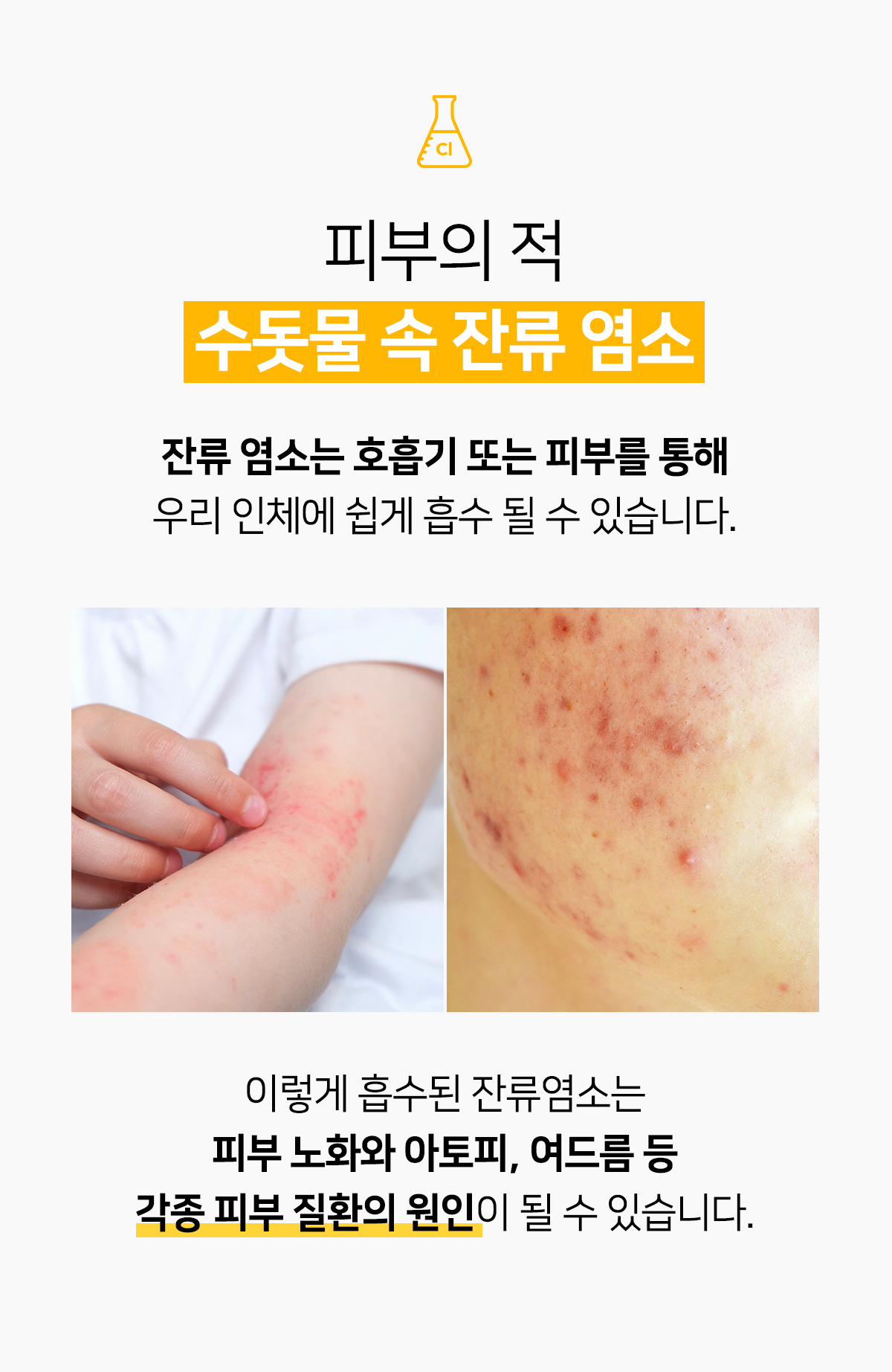 아로미카